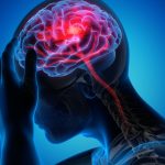 Natural Remedies for Migraines — What You Should Try for Gentle Relief