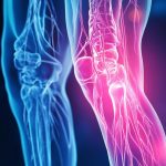 Best Joint Health Supplements Reviewed: Support for Pain, Flexibility & Mobility